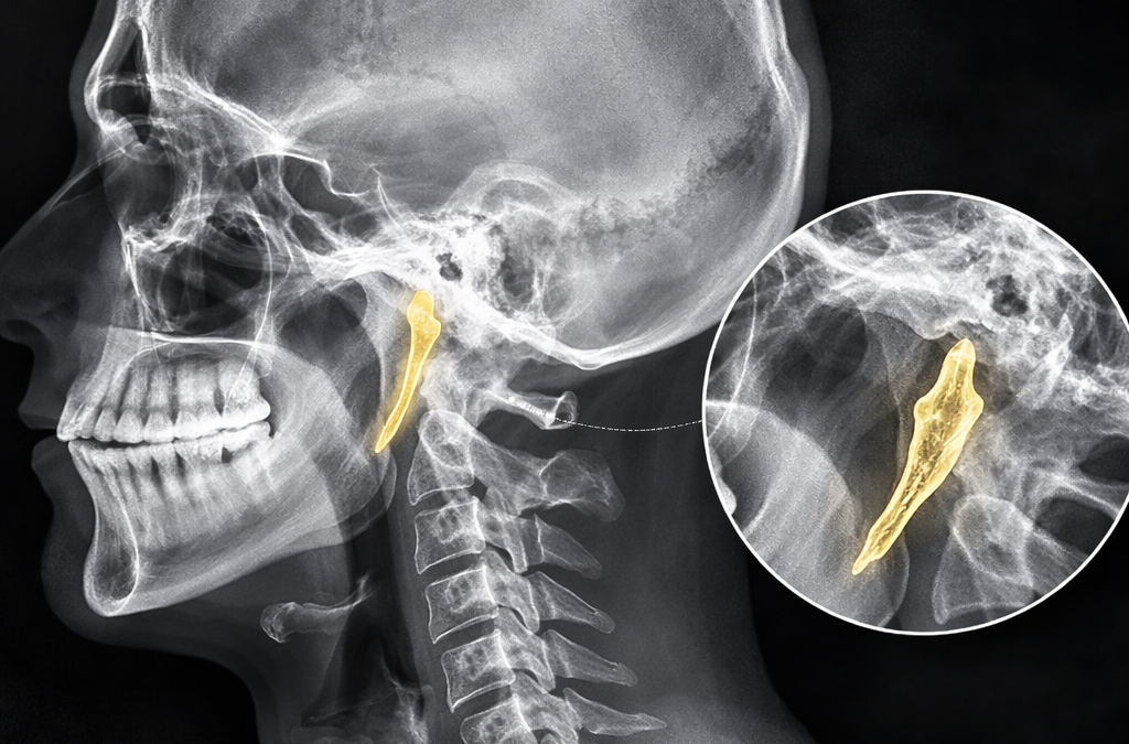 Najczęstsze wrodzone anomalie układu nerwowego, które każdy terapeuta powinien znać